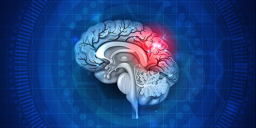 Centre for Neuro Skills
