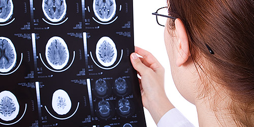 Centre for Neuro Skills