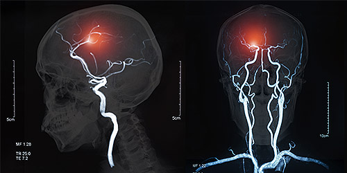 Centre for Neuro Skills